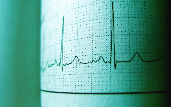 Peste jumătate dintre români mor din cauza bolilor cardiovasculare: 58,4% dintre decese sunt provocate de afecțiunile inimii